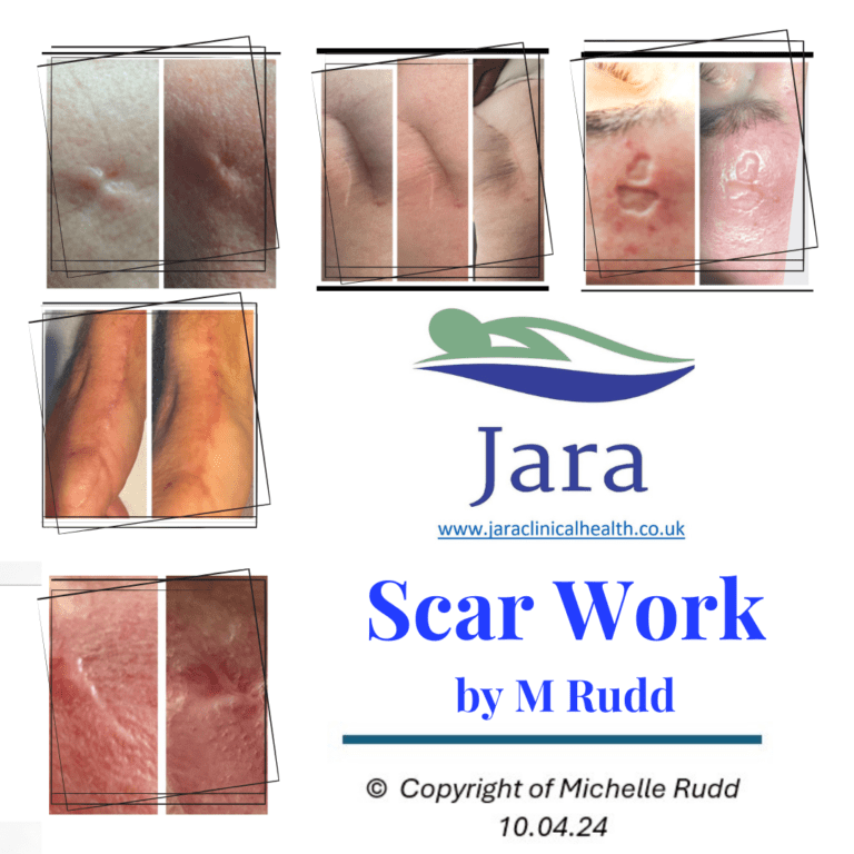 Scar Work 768x768