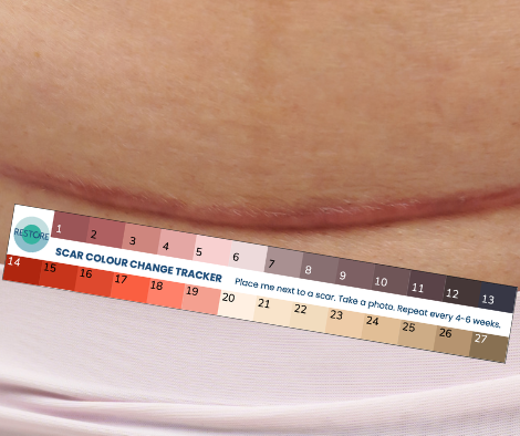page image scar colour tracker